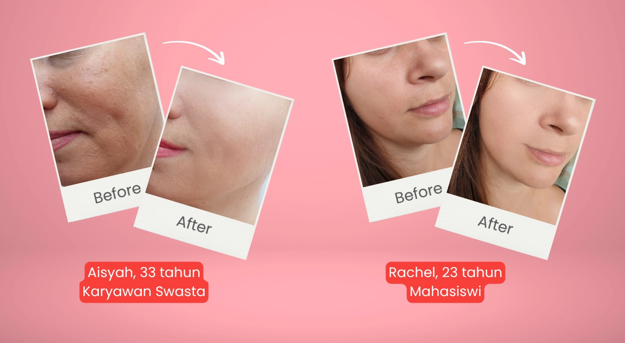 https://centralmedika.com/wp-content/uploads/2025/08/before-after-2-copy.webp